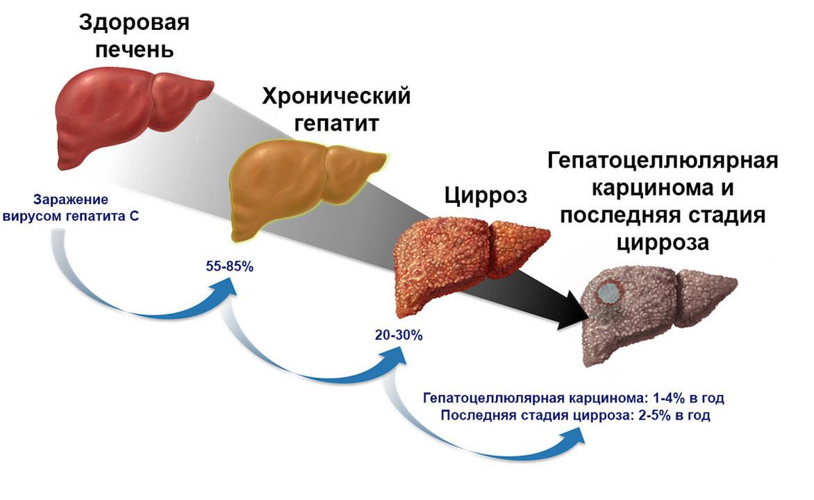 В Грозном стартовала Неделя борьбы с заражением и распространением вирусного гепатита С